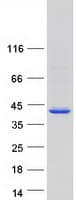 Human ANKRD16 Protein (Recombinant Myc-DDK (Flag))