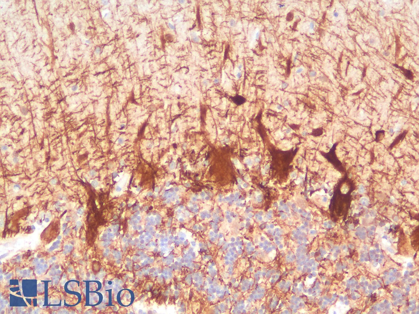 PathPlus™ NF-L / NEFL Antibody (clone NEFL/2983R)