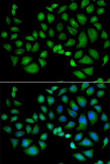 Polyclonal Rabbit anti-Human CLIC1 / NCC27 Antibody (IHC, IF, WB)