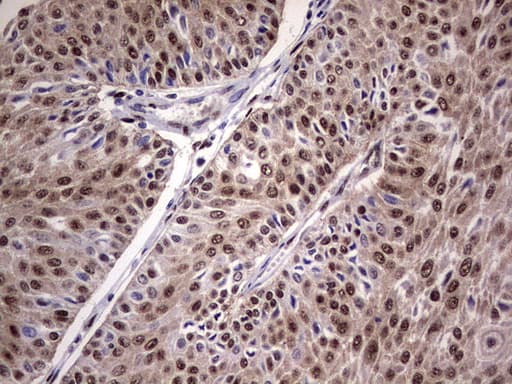 C14orf166 Antibody (clone OTI1E5)
