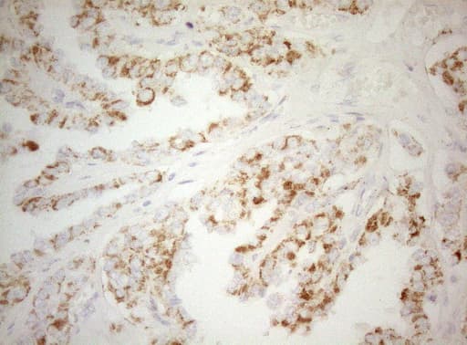 DECR1 Antibody (clone OTI8F11)