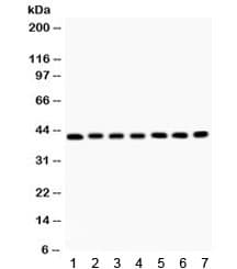 Polyclonal Rabbit anti-Human ACTA1 / Skeletal Muscle Actin Antibody (IHC, WB)