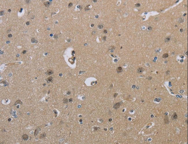 Polyclonal Rabbit anti-Human HSD3B1 Antibody (IHC, WB)