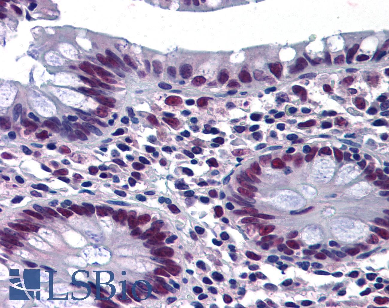 IHC-plus™ CHEK2 / CHK2 Antibody (clone 4B7)