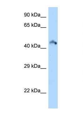 RIMKLB Antibody (aa191-240)