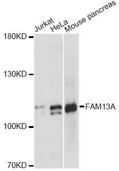 FAM13A1 / KIAA0914 Antibody