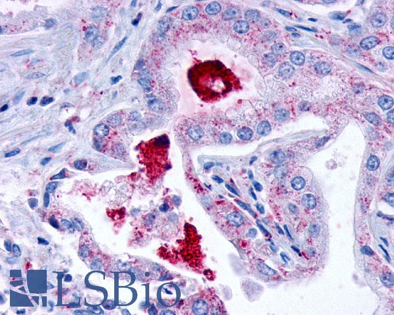 PathPlus™ Polyclonal Rabbit anti-Human LPAR3 / LPA3 / EDG7 Antibody (Cytoplasmic Domain, IHC)