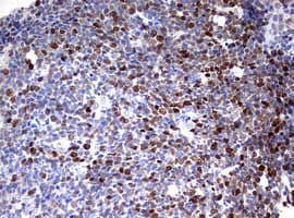 Monoclonal Mouse anti-Human TOP2A / Topoisomerase II Alpha Antibody (clone OTI2F8, aa1100-1531, IHC, WB)