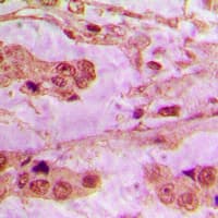 API5 Antibody (C-Terminus)