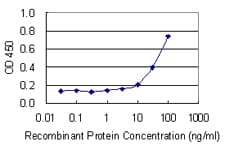 IHC-plus™ Monoclonal Mouse anti-Human NHLH1 / HEN1 Antibody (clone 4D7, IHC)