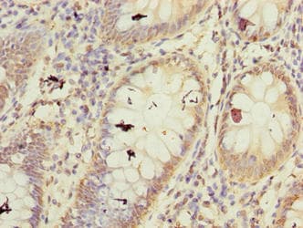 FBXW10 Antibody
