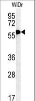 Polyclonal Rabbit anti-Human TANK Antibody (aa88-114, IHC, WB)