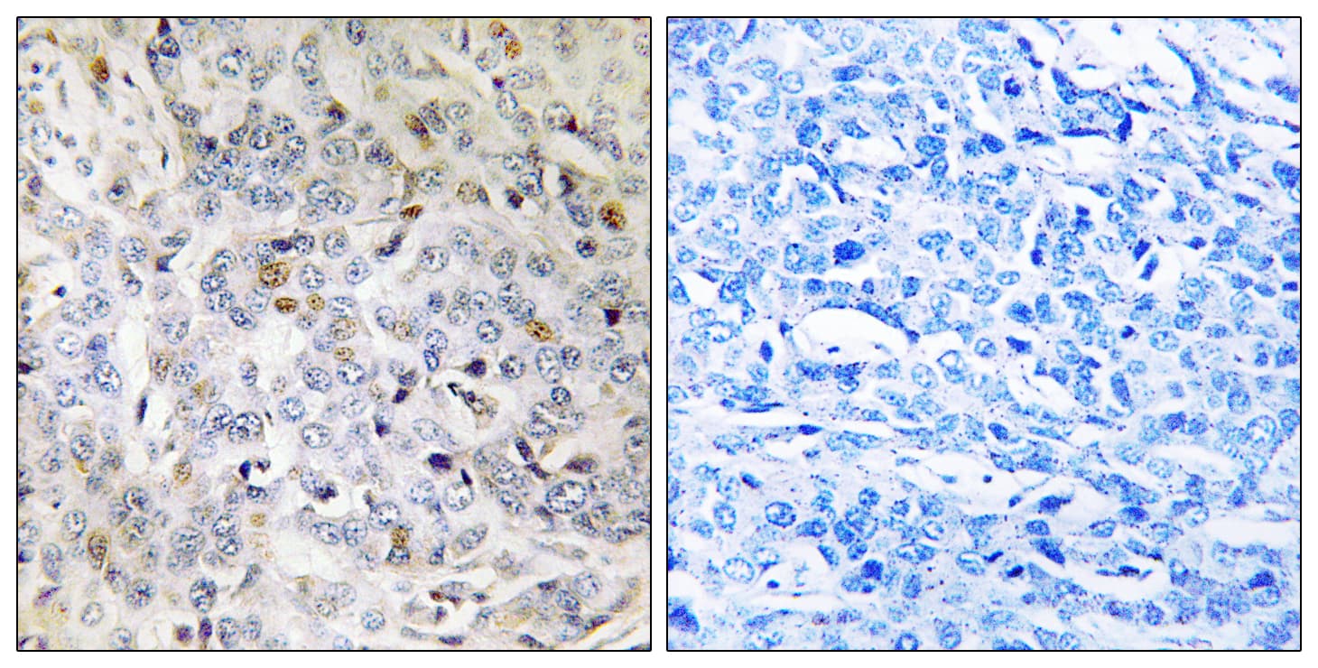 Polyclonal Rabbit anti-Human PDIK1L Antibody (aa101-150, IHC, WB)