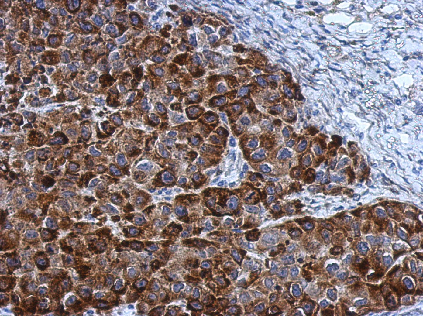 NOL3 / ARC Antibody