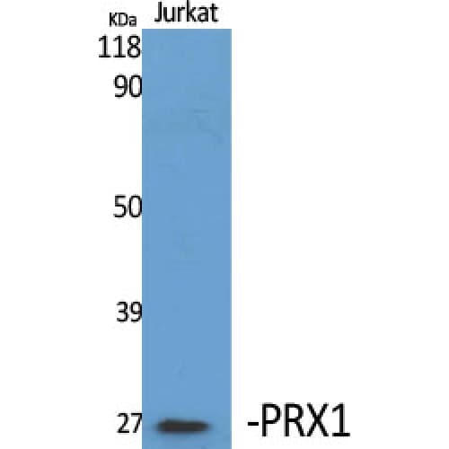 PRX-1 / PRRX1 Antibody (30-110 aa, Internal)