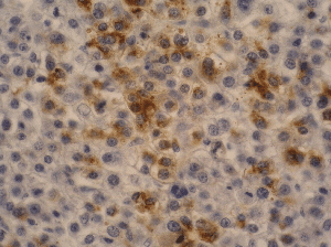 Monoclonal Mouse anti-Human Alpha-Fetoprotein Antibody (clone AFP-11, IHC)