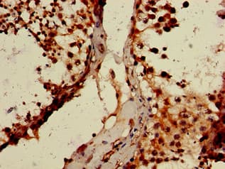 Polyclonal Rabbit anti-Human WTAP Antibody (IHC, IF, WB)
