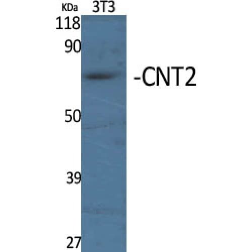 SLC28A2 Antibody (340-420 aa, Internal)
