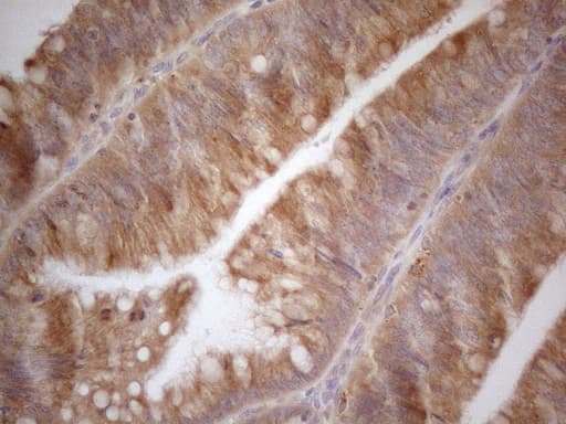VIP Antibody (clone OTI1C3, Carrier-free)
