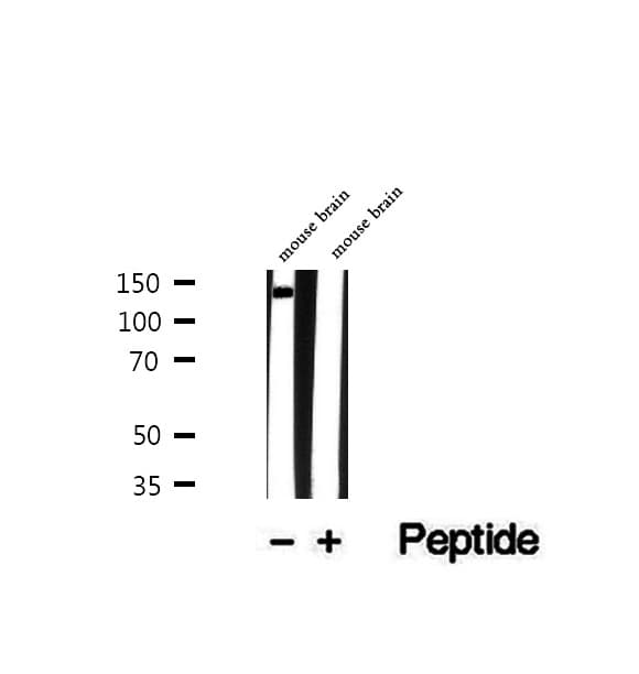 Polyclonal Rabbit anti-Human TRAPPC9 Antibody (IHC, IF, WB)