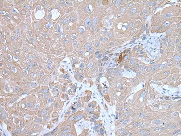 Polyclonal Rabbit anti-Human IMP-3 / IGF2BP3 Antibody (IHC, WB)