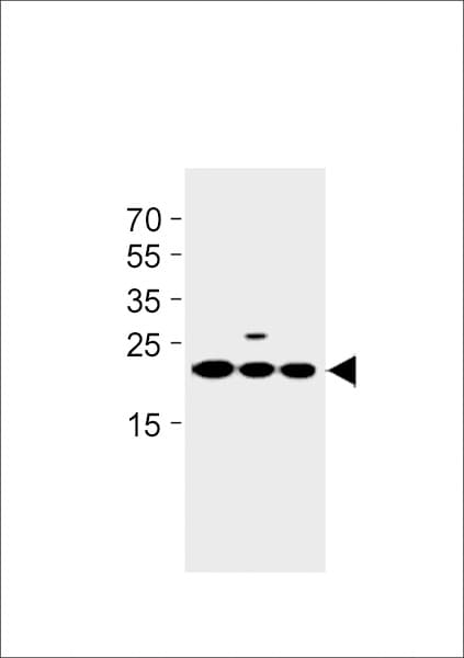 Polyclonal Rabbit anti-Human TMEM199 Antibody (aa46-75, WB)