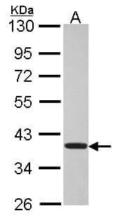 Polyclonal Rabbit anti-Human TSSC1 Antibody (aa1-192, WB)
