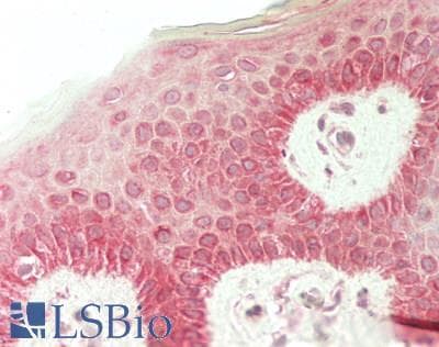 IHC-plus™ RHCG Antibody (aa5-15)