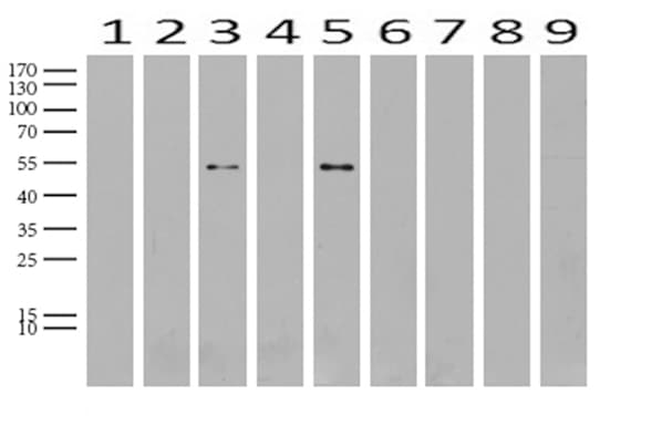 ABAT Antibody (aa29-323, clone UMAB180)