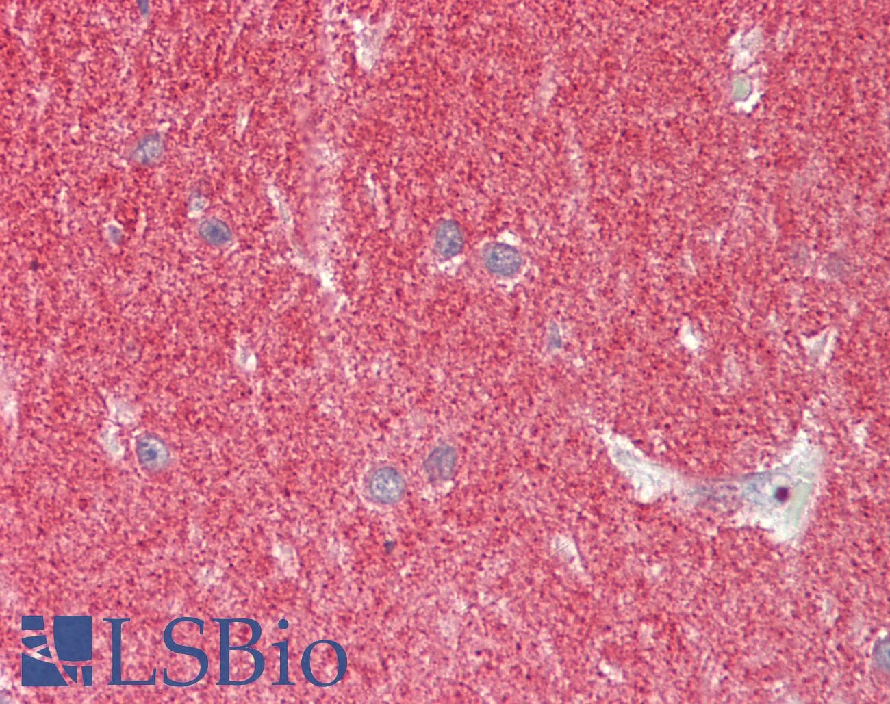 PathPlus™ SNCA / Alpha-Synuclein Antibody (aa97-110)