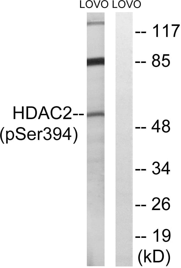 HDAC2 Antibody (phospho-Ser394)
