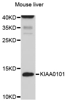 PCNA-Associated Factor Antibody