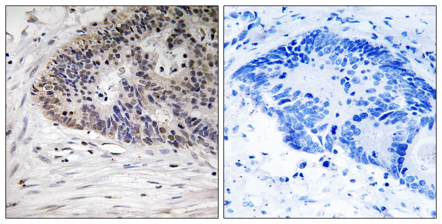 MDM4 / MDMX Antibody (phospho-Ser367)