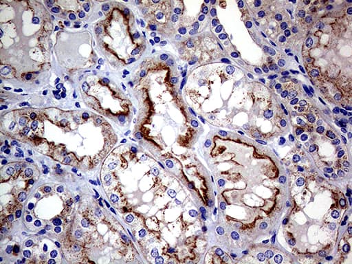 CLTA / LCA Antibody (clone OTI2F7)