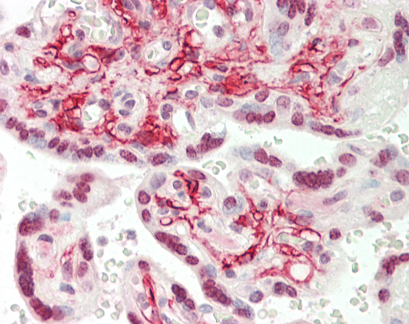 PPP2R5D Antibody (C-Terminus)