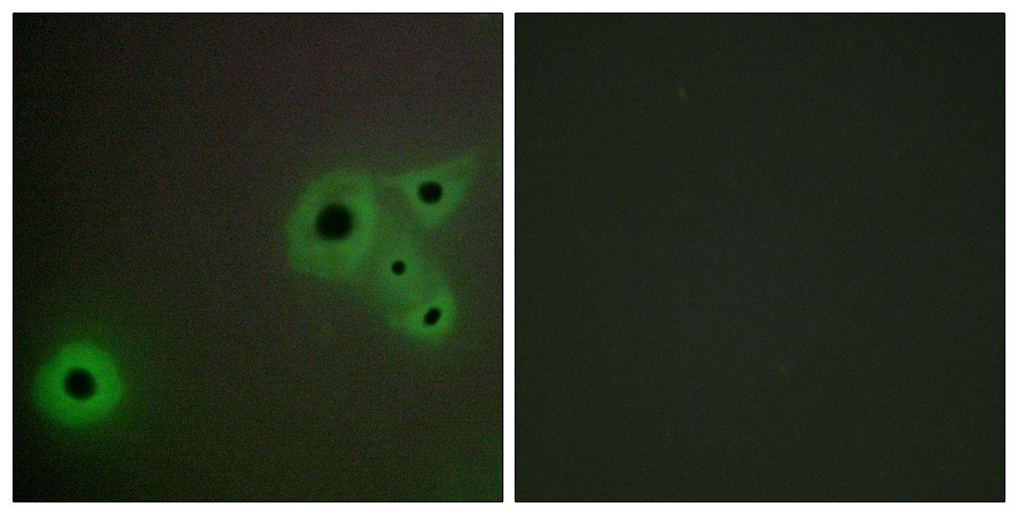 Polyclonal Rabbit anti-Human MED23 / SUR2 Antibody (IHC, IF)