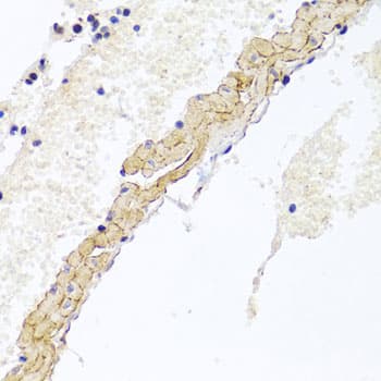 CD81 Antibody