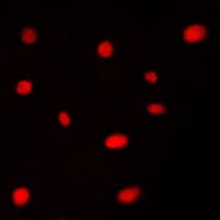 Polyclonal Rabbit anti-Human AATF Antibody (N-Terminus, IHC, IF, WB)