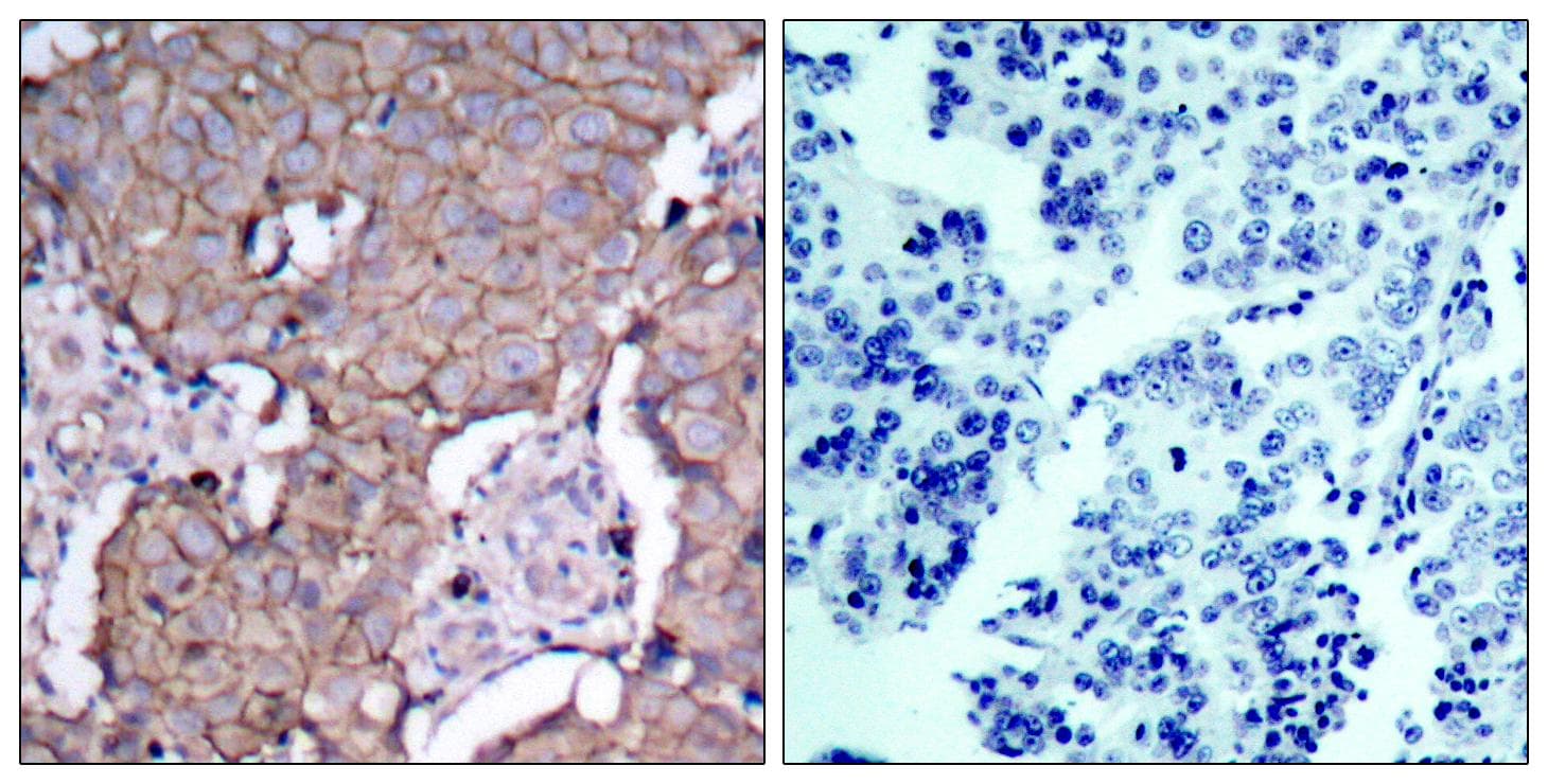 Polyclonal Rabbit anti-Human ERBB2 / HER2 Antibody (p877, IHC, WB)