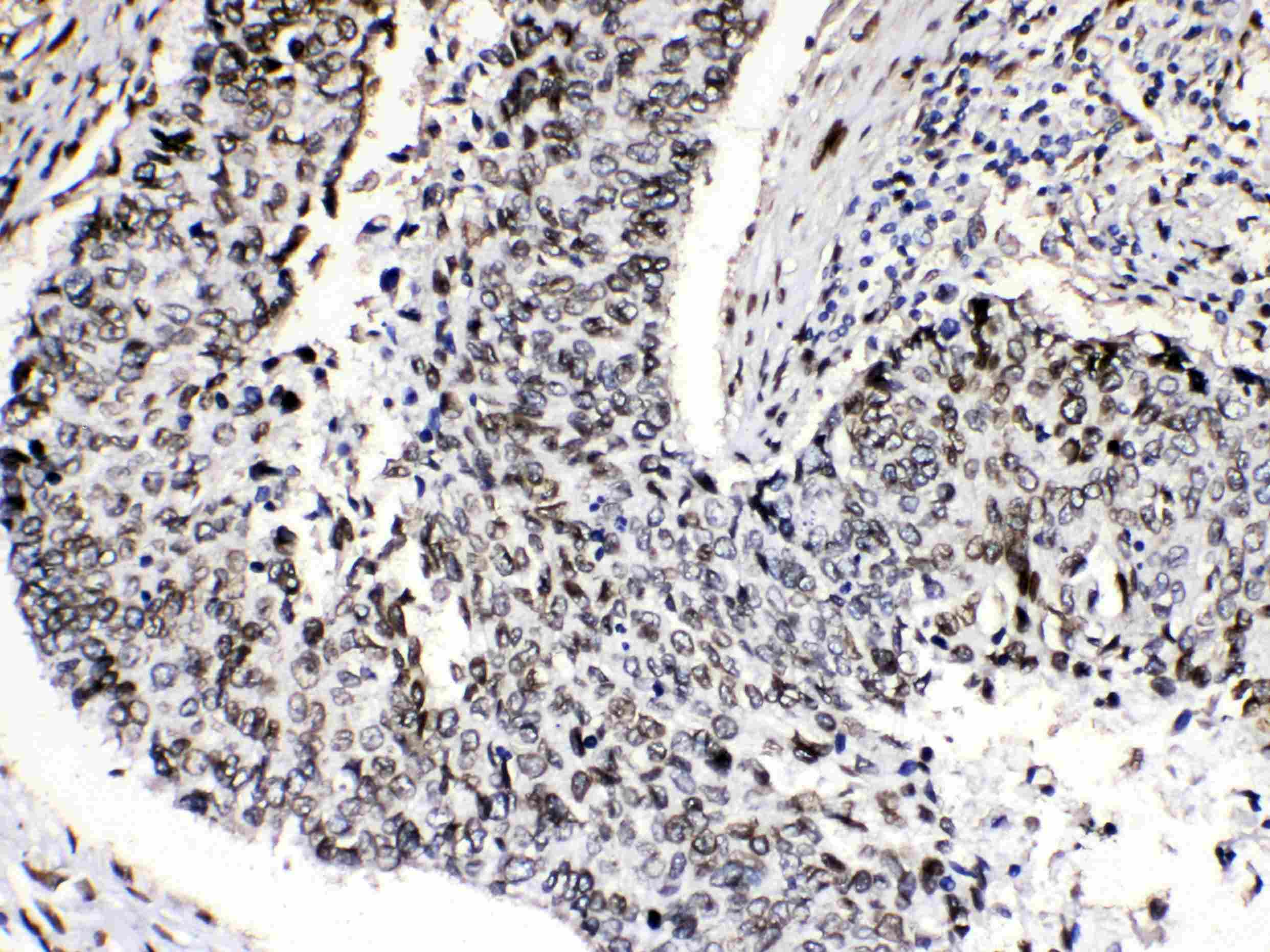 Polyclonal Rabbit anti-Human EMD / Emerin Antibody (IHC, WB)