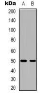CACNB3 / Cavbeta3 Antibody