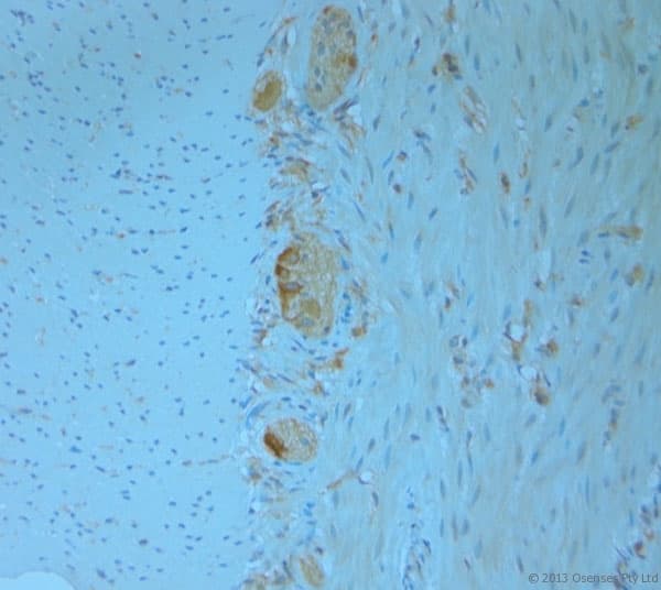 Polyclonal Rabbit anti-Human REEP5 Antibody (aa150-189, IHC)