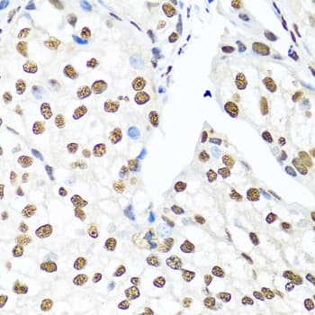 XRCC5 / Ku80 Antibody
