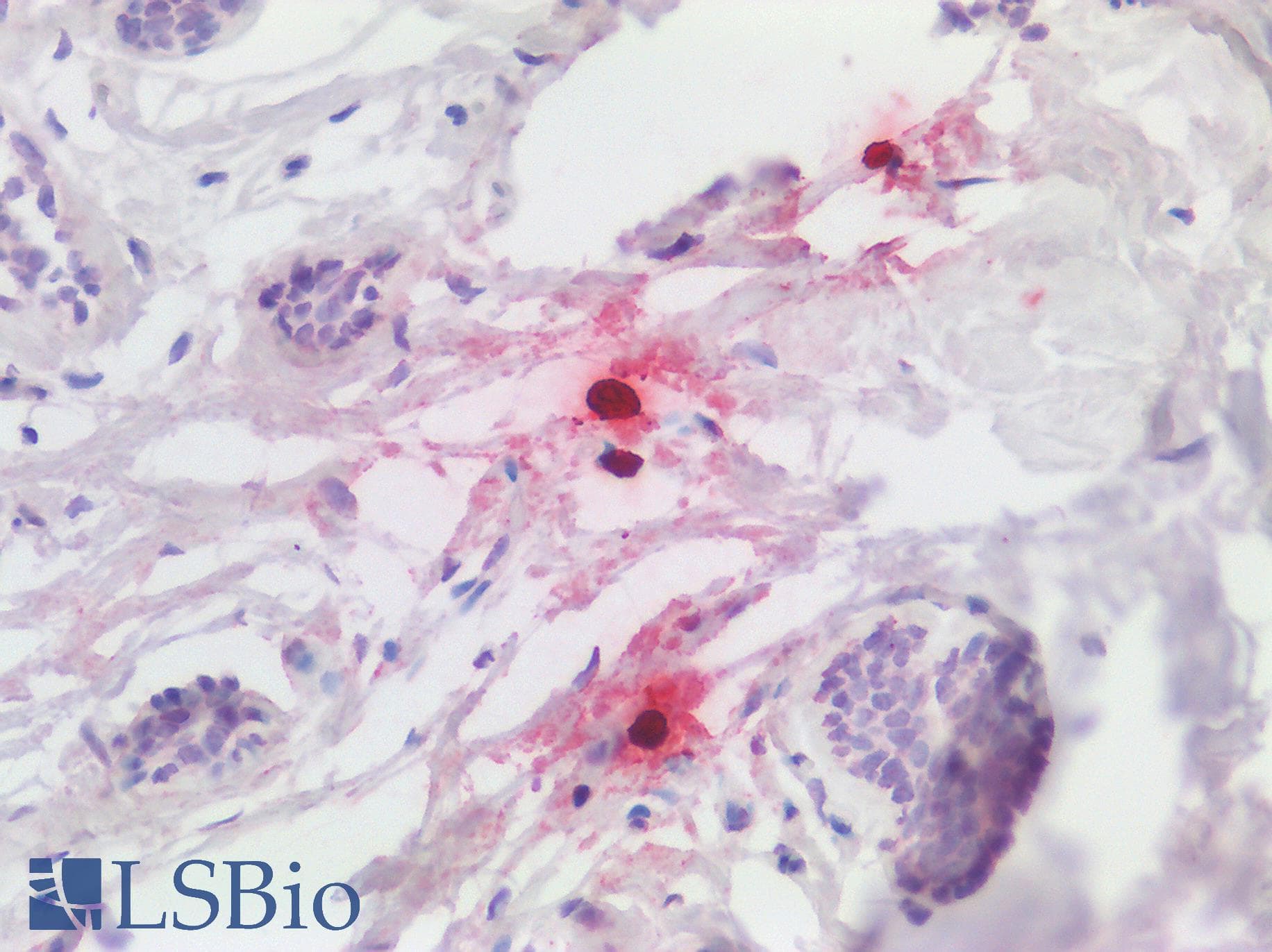 IHC-plus™ CMA1 / Mast Cell Chymase Antibody (aa96-110)