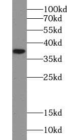 CDX2 Antibody