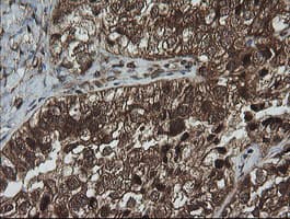 CRYAA / Alpha A Crystallin Antibody (clone OTI3B12, Carrier-free)