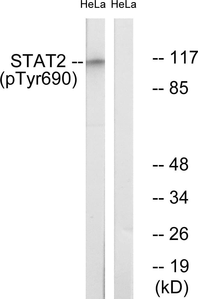 STAT2 Antibody (phospho-Tyr690)