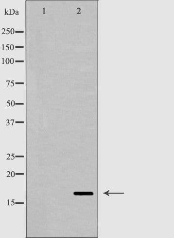 RNASE12 Antibody