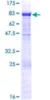 Human EPHX2 / Epoxide Hydrolase 2 Protein (Recombinant GST)