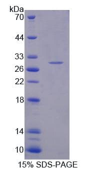 Human PSMA5 Protein (Recombinant His-T7)